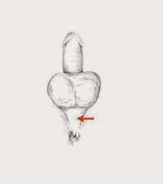 قوة العضلات وتوترها لزيادة قوتها